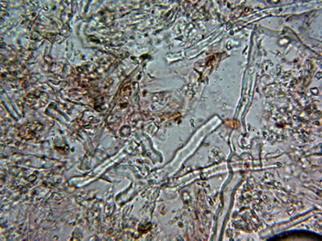 Byssocorticium?